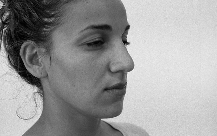 H&ouml;ckernase mit fleischiger Spitze, vor der Operation.