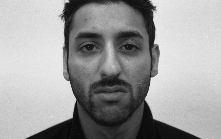 H&ouml;cker-Langnase, gro&szlig;bogig mit breiter Spitze. Vor der Operation.