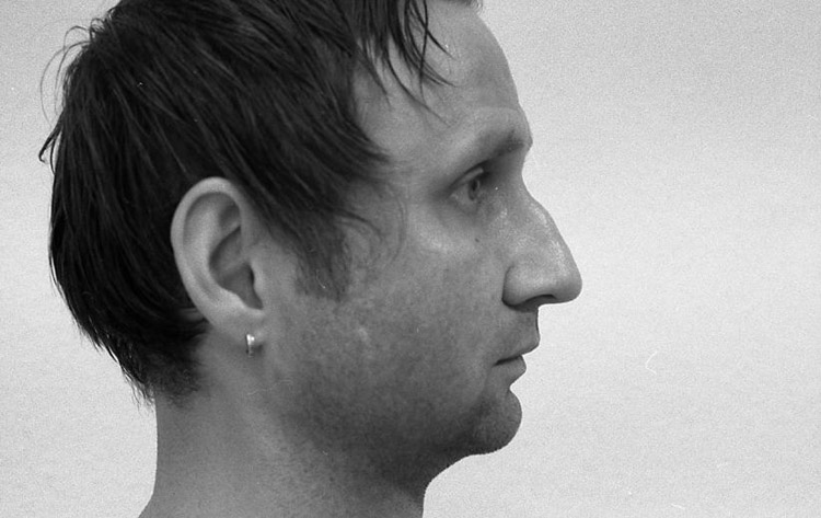 H&ouml;cker-Gro&szlig;nase, vor der Operation. 