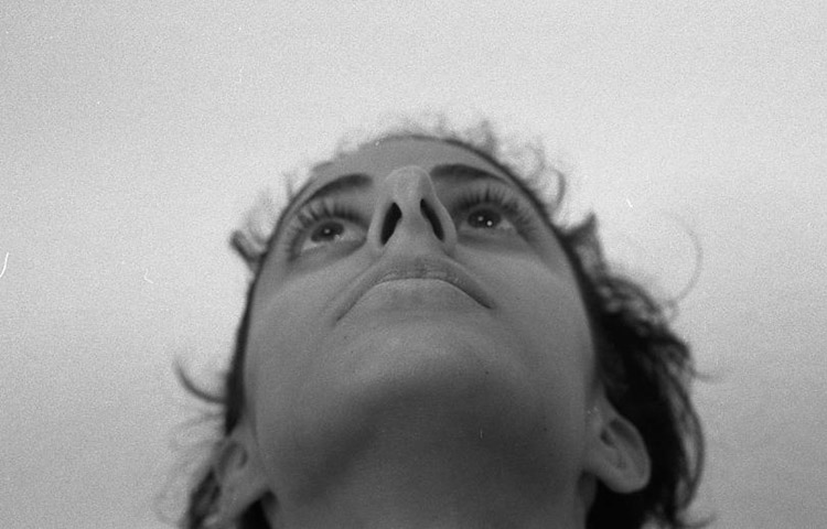 H&ouml;cker-Gro&szlig;nase, bei Gesichtsasymmetrie und schiefem Nasensteg. Vor der Operation.