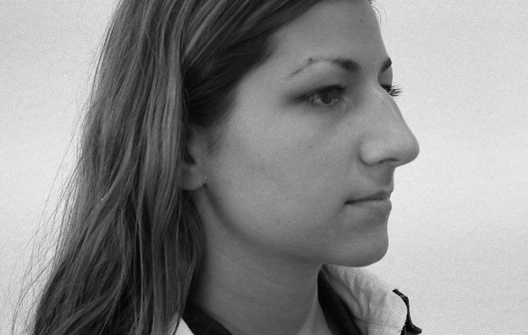 H&ouml;cker-Gro&szlig;nase, vor der Operation. 