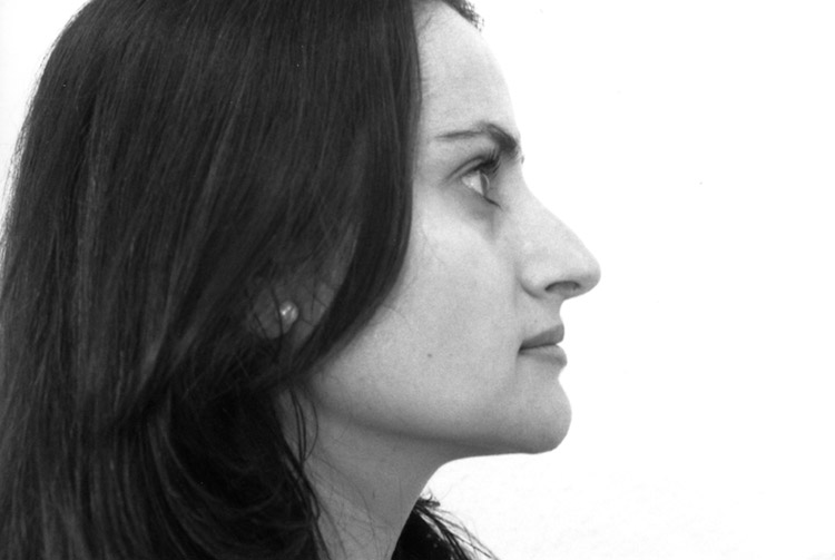 H&ouml;cker-Langnase mit breiter Spitze. Vorder Operation.