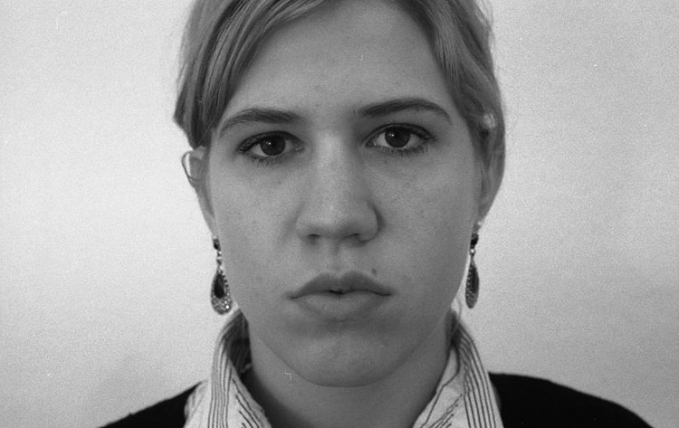 H&ouml;cker-Breit-Sattelnase (Unfall). Vor der Operation. 