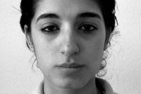 Einfache H&ouml;ckernase vor der Operation