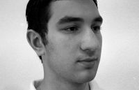 Unf&ouml;rmig breite, fleischige Nase.Vor der OP.