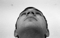 Unf&ouml;rmig breite, fleischige Nase.Vor der OP.