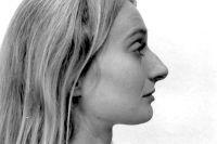 H&ouml;cker-Gro&szlig;nase vor der OP